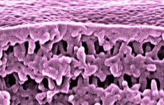 Material nanoporoso
