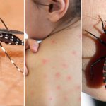 Dengue, chagas y sarampión: Los brotes silenciosos