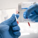 Científicos de Chemtest y UNSAM desarrollarán el primer test de antígenos 100% argentino